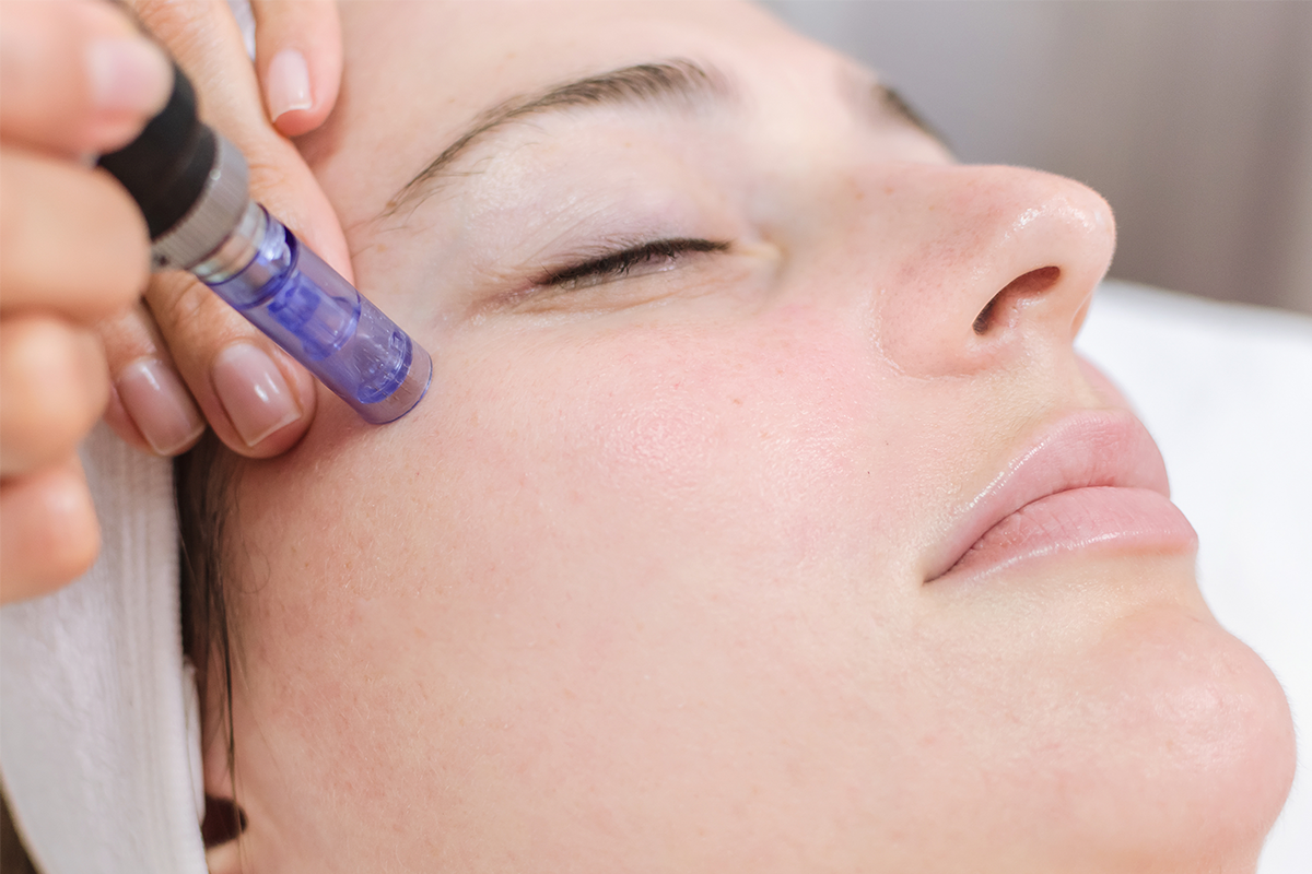 Advanced Microneedling (Collagen Induction Therapy)